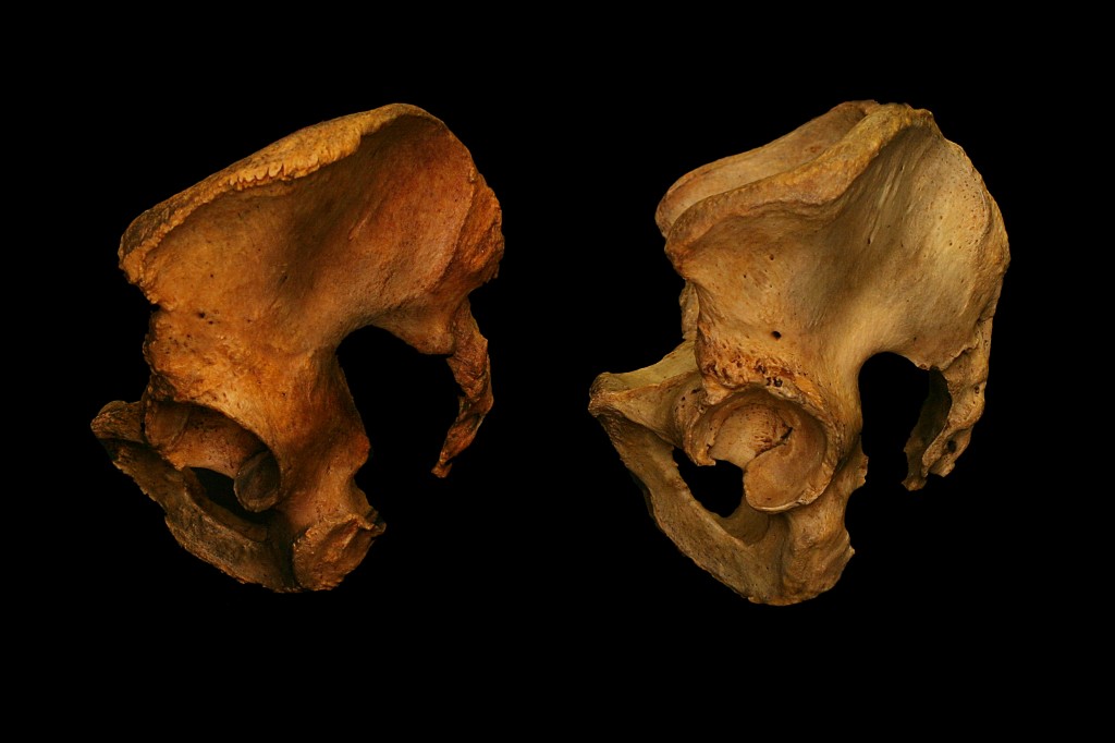 Not All Bones Are Created Equal => Not Everyone Splits the Same | www